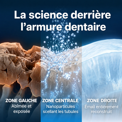Armure dentaire Oxyteeth
