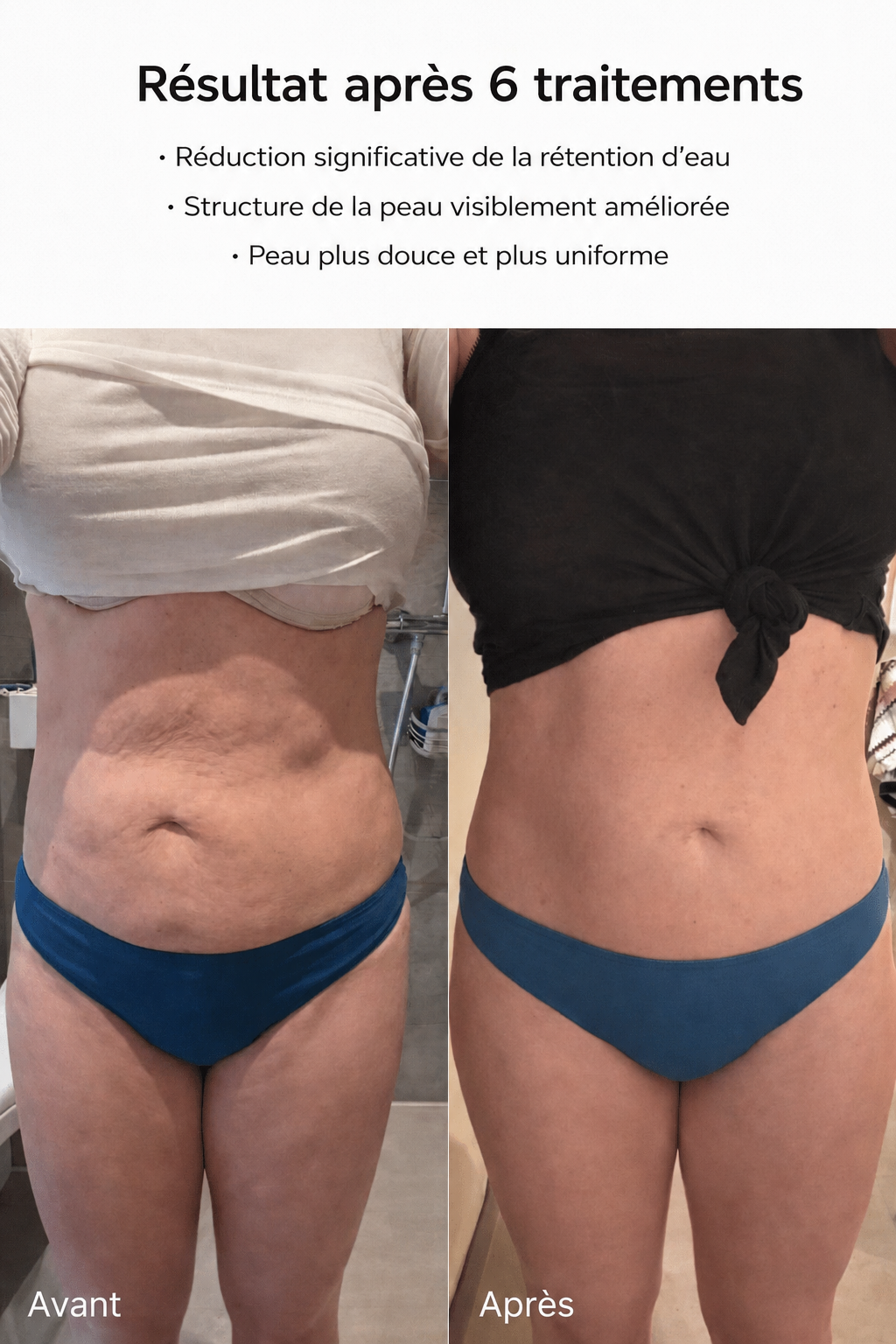Luxeon – peau lisse en 14 jours