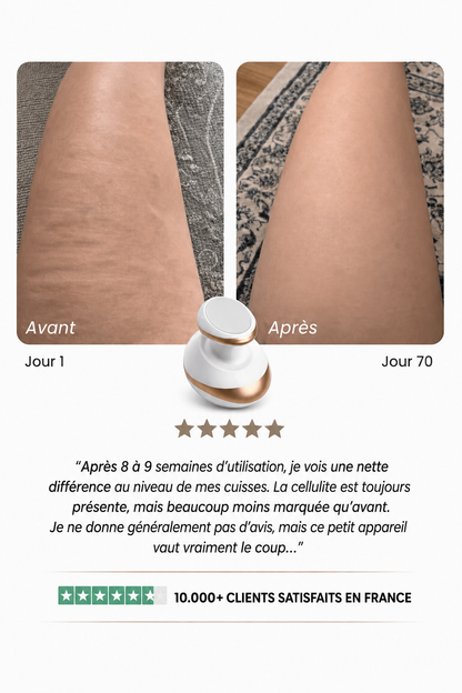 Luxeon – peau lisse en 14 jours