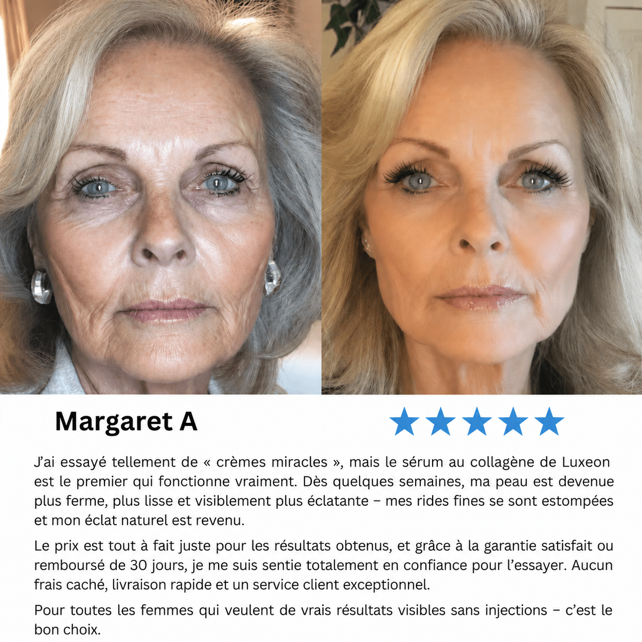 VoluFine | Sérum coréen au collagène pour peaux matures