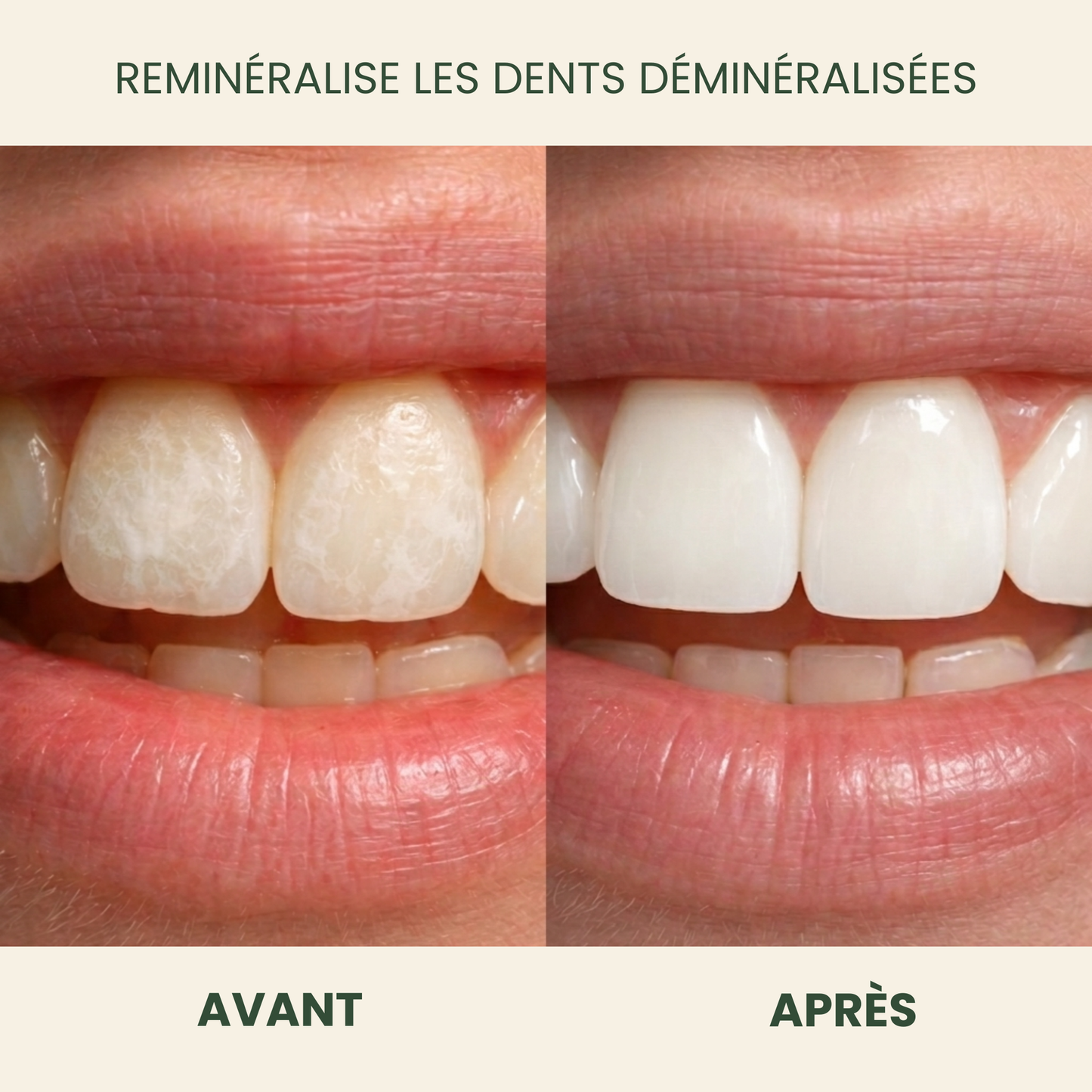 Luxeon Chewing-gum Reminéralisant