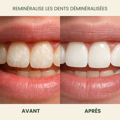 Luxeon Chewing-gum Reminéralisant