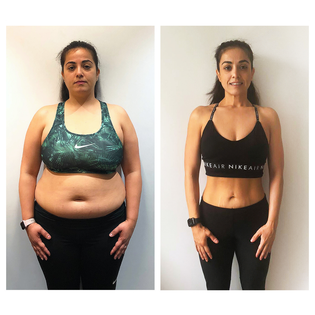 Patchs minceur Luxeon™