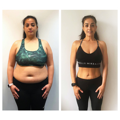 Patchs minceur Luxeon™