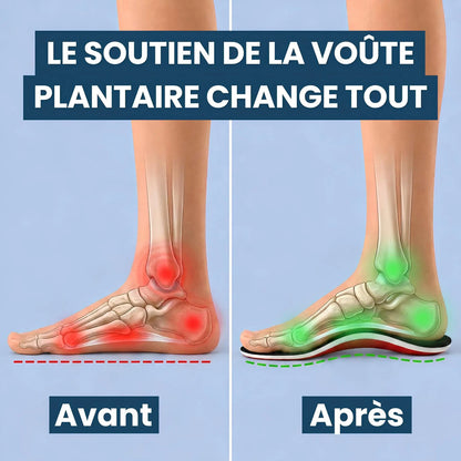 LUXEON™| Semelles de Soutien de la Voûte Plantaire