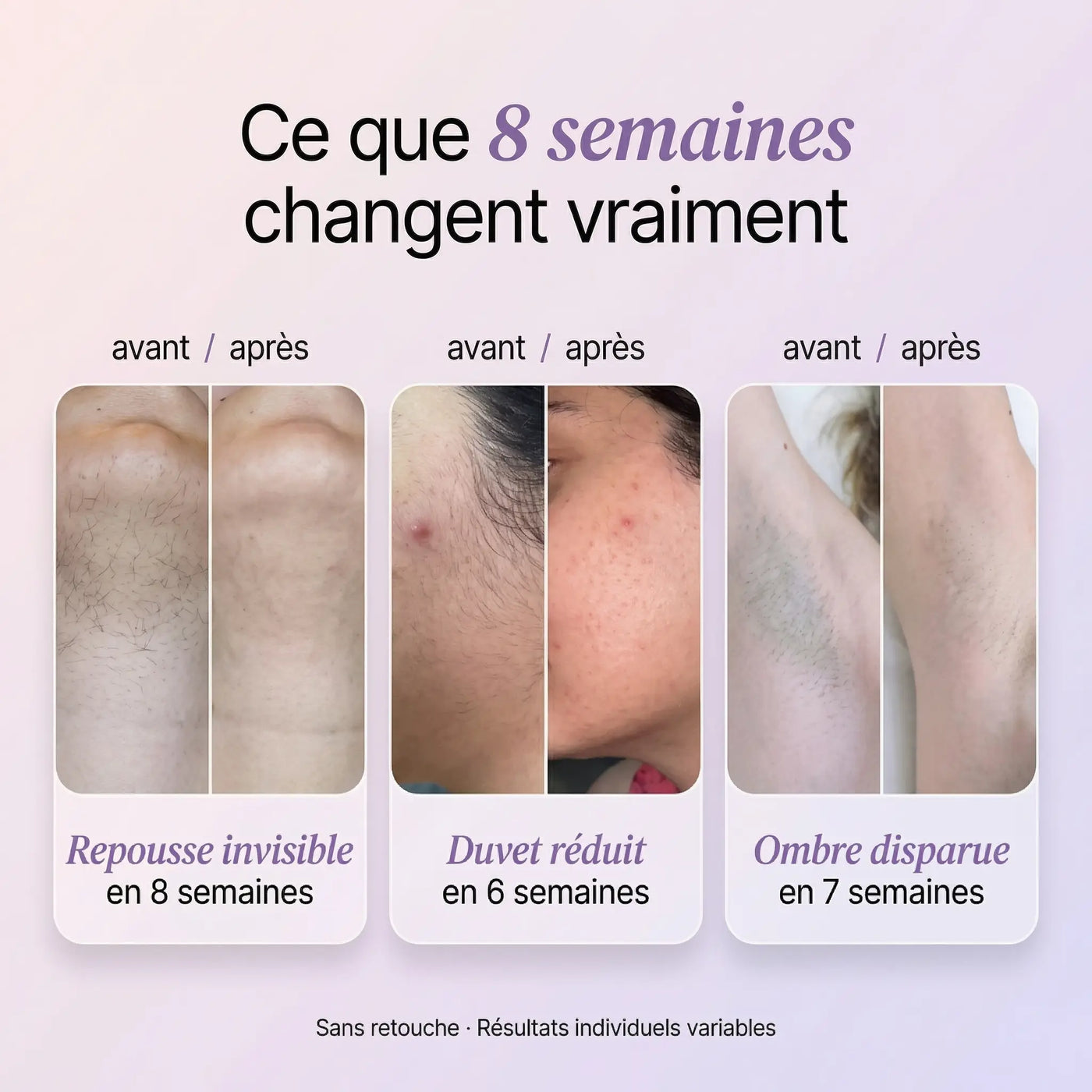Sérum Anti-Repousse 100% Naturel - Fini de se cacher à cause de ses poils