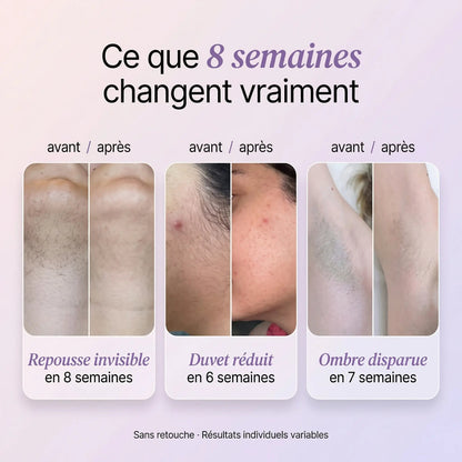 Sérum Anti-Repousse 100% Naturel - Fini de se cacher à cause de ses poils