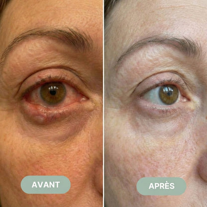 EyeComfort Pro