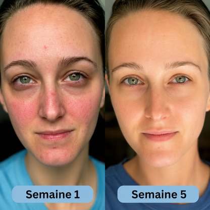 VoluFine | Sérum coréen au collagène pour peaux matures